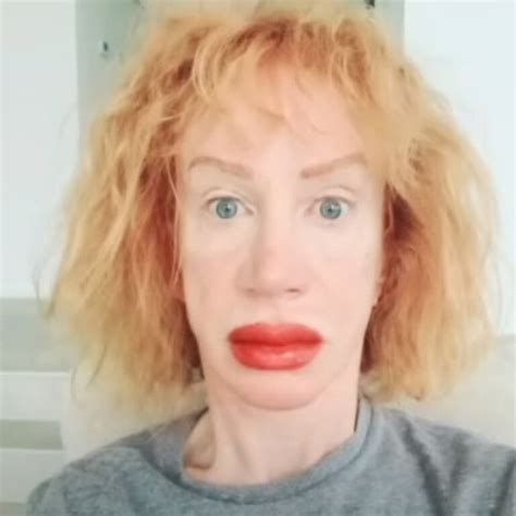 Kathy Griffin Shocks Fans With Dramatically Swollen Lips After Tattoo