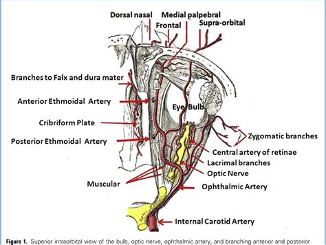 Figure From Ethmoidal Arteries And Vascularized Anterior Skull Base