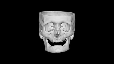 Skull Male 53yo 3d Model By Terrie Terrielsimmons 01f0fd5