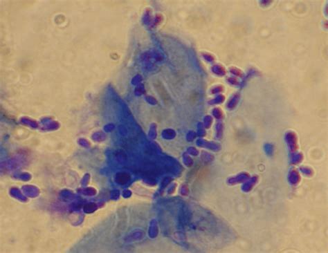 Skin Cytology From A Dog With Malassezia Dermatitis Numerous Typical