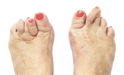 Triad Foot And Ankle Center