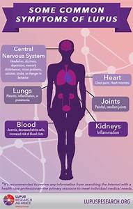 Lupus Symptoms Infographic Lupus Research
