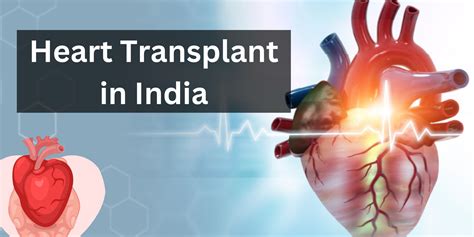 Heart Transplant In India Know The Best Doctors Hospitals Cost And More