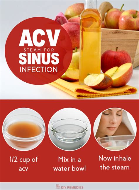 But when i went hunting for studies to support these claims, what i found instead. How to Clear Sinus Infection with Apple Cider Vinegar