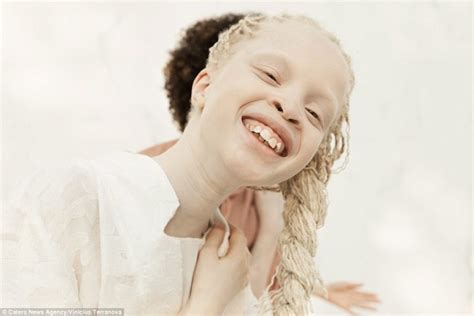 These Stunning Twins With Albinism Are Taking The Modeling Industry By Storm Allure