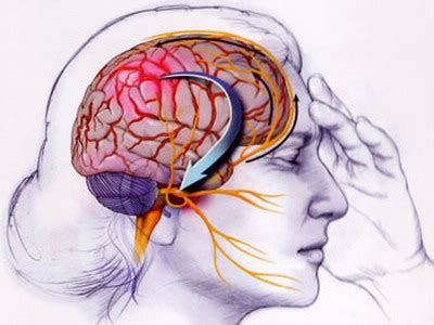 Agregó que es así, como al paciente en razón a su estado clínico, se le diagnostica muerte encefálica y que tras el diagnóstico lo que viene será que su corazón deje de latir en un par de horas. Anomalías cerebrales en pacientes con migraña - MIGRAÑA