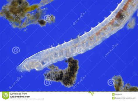 Microscopic View Of Oligochaete Worm Stock Photo Image Of Oligochaeta