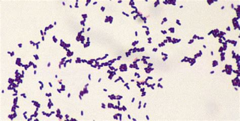 Listeria Monocytogenes Zdravlje