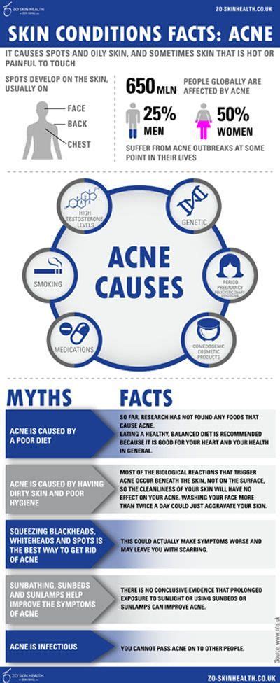 What Is Acne Infographic Skin Care Acne Acne Acne Care
