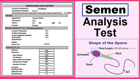 Importance Of Semen Analysis An Overview Helal Medical