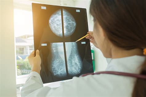 Understanding The Process Of The Mammogram Procedure