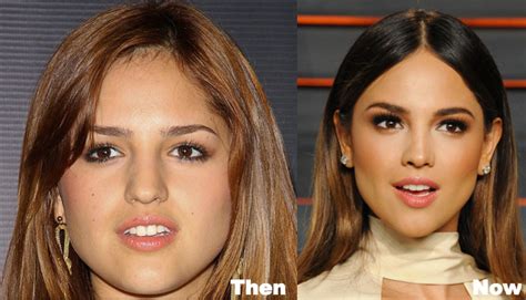 Eiza Gonzalez Plastic Surgery Before And After Photos The Best