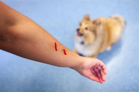 Dog Bite Injury Attorneys Mercer County New Jersey