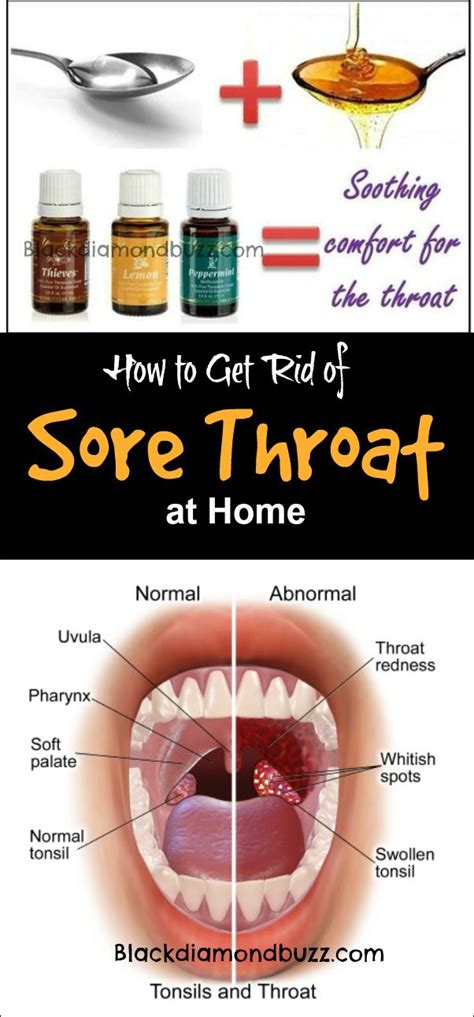 essential oil for sore throat that work fast