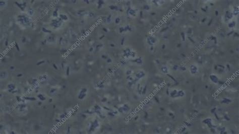 E Coli Bacteria Microscopy Stock Video Clip K0069594 Science