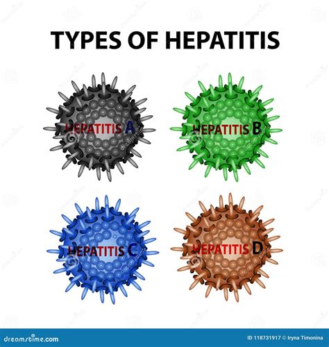Tipos De Hepatitis Hepatitis a B C D De Los Virus Infografía Ejemplo