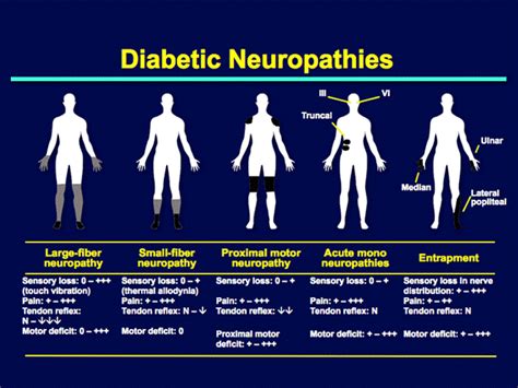 Peripheral Neuropathy — Diagnosis And Treatment By Dmemd Source Medium