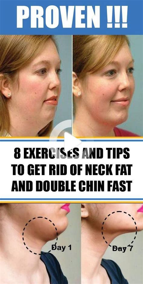 How To Reduce Face Fat In 5 Days Keitodecairesnawa Pages Dev