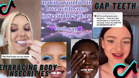 Embracing Body Insecurities Gap Teeth Youtube