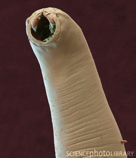 Hookworm Coloured Scanning Electron Micrograph Sem Of The Head Of The Parasitic Nematode
