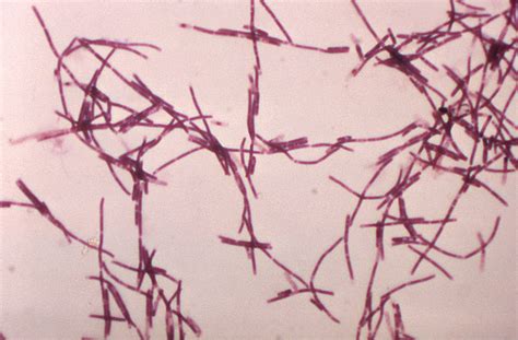 Imagen Gratis Gramo Microfotografía Numeroso Bacillus Anthracis