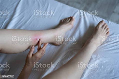 Asian Female Touches Her Leg After Being Bitten By Mosquito At Home