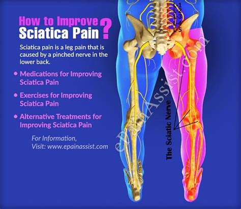 Top 93 Pictures Pictures Of The Sciatic Nerve Latest 102023