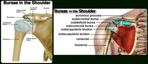 Jump to info about finding the right supplement. Shoulder Bursitis - Treatment, Exercises, What is, Symptoms