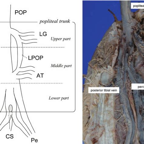 Pdf Significance Of The Soleal Vein And Its Drainage Veins In Cases
