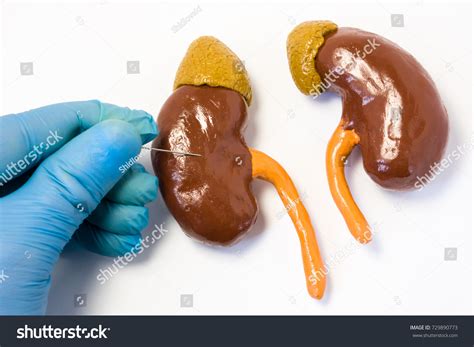 832 Kidney Biopsy Images Stock Photos And Vectors Shutterstock