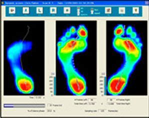 Special Footwear Orthotics In London Gait Analysis Feet Care