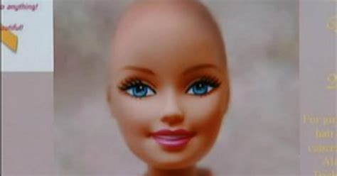 South Jersey Woman Urging Mattel To Create Beautiful And Bald Barbie