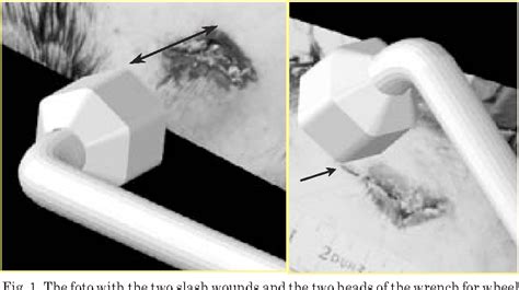 Figure 1 From Forensic 3 D Cad Supported Photogrammetry Fphg Bite Mark Evaluation And