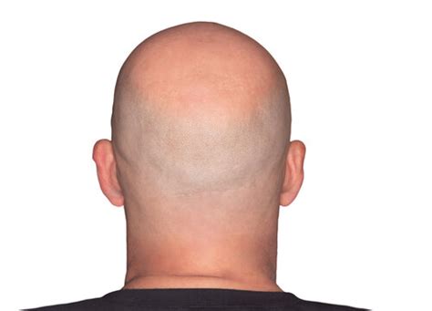 Back Of Bald Head Images Browse 2538 Stock Photos Vectors And
