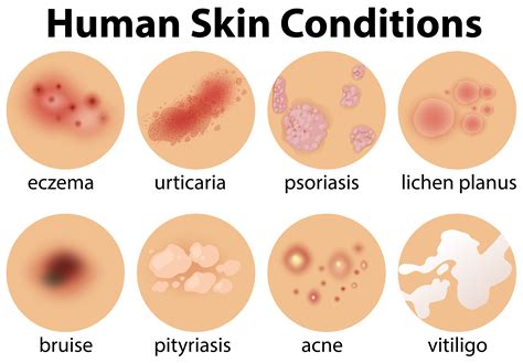 Types Of Skin Conditions