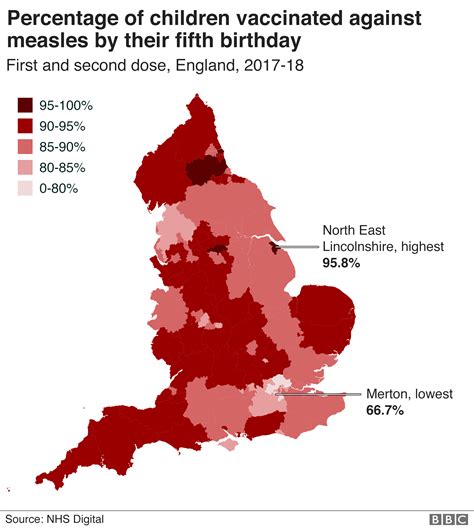 Measles Cases In Uk 2024 Alana Augusta