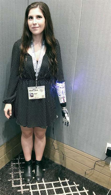 Bionic Woman Posts Picture Of Her Cyborg Problems At Sxsw Houston