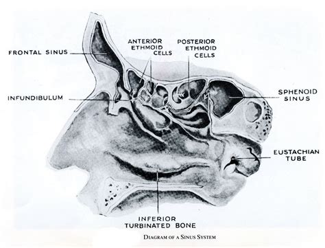 The nasal cavity is inspected by anterior rhinoscopy or endoscopy following decongestion and local anesthesia of the mucosa. Medical Zero: What is Sinusitis and How is Sinusitus Treated?