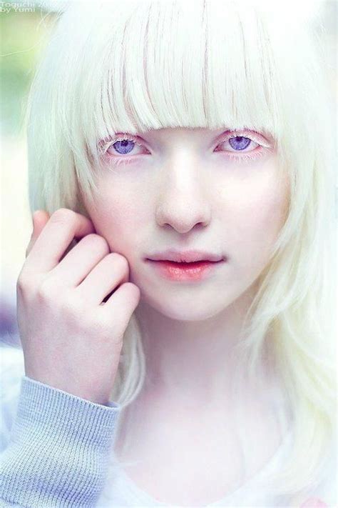 Albino On Pinterest 75 Pins Albino Model Albino Girl Albinism