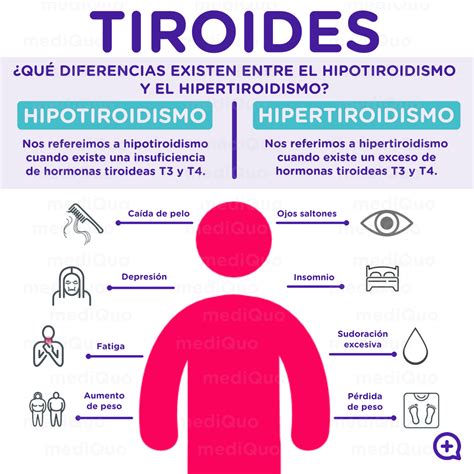 Diferencias Entre Hipotiroidismo E Hipertiroidismo Ud Vrogue Co