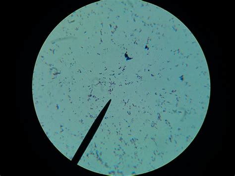 Bacteria Smear Gram Stained Light Microscope Total Mag