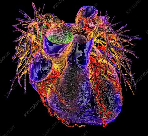 Human Heart 3d Ct Scan Stock Image C0515783 Science Photo Library