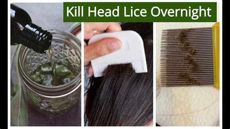 How To Remove Lice From Hair Home Remedies In Hindi Attack On Titan