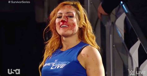 Becky Lynch Becoming The Man Explained