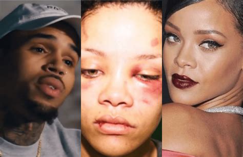 “she Hit Me First” Chris Brown Finally Opens Up On 2009 Fight With Former Lover Rihanna Wothappen