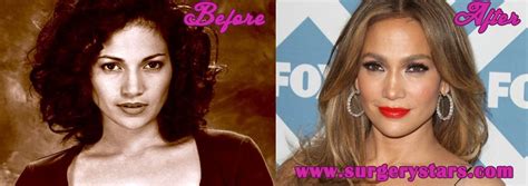 Jennifer Lopez Nose Job Before And After Pictures