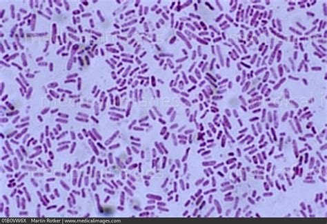 Stock Image Photomicrograph Of Salmonella Sp A Gram Negative Enteric