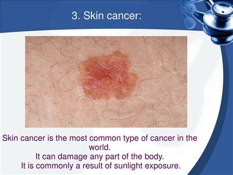 Ppt What Are The Common Skin Problems Powerpoint Presentation Free