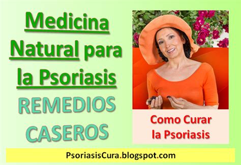 Psoriasis Cura Natural Tratamientos Naturales Para Curar La Soriasis