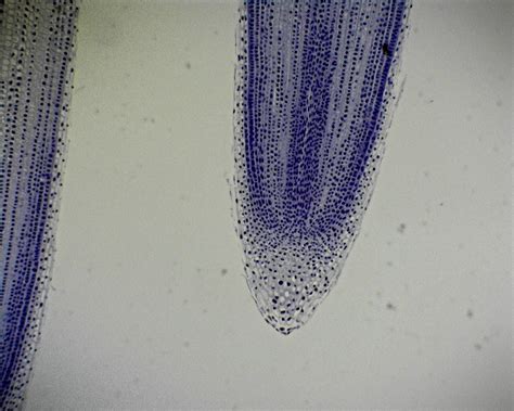 E8a11435 Philip Harris Prepared Microscope Slide Onion Allium